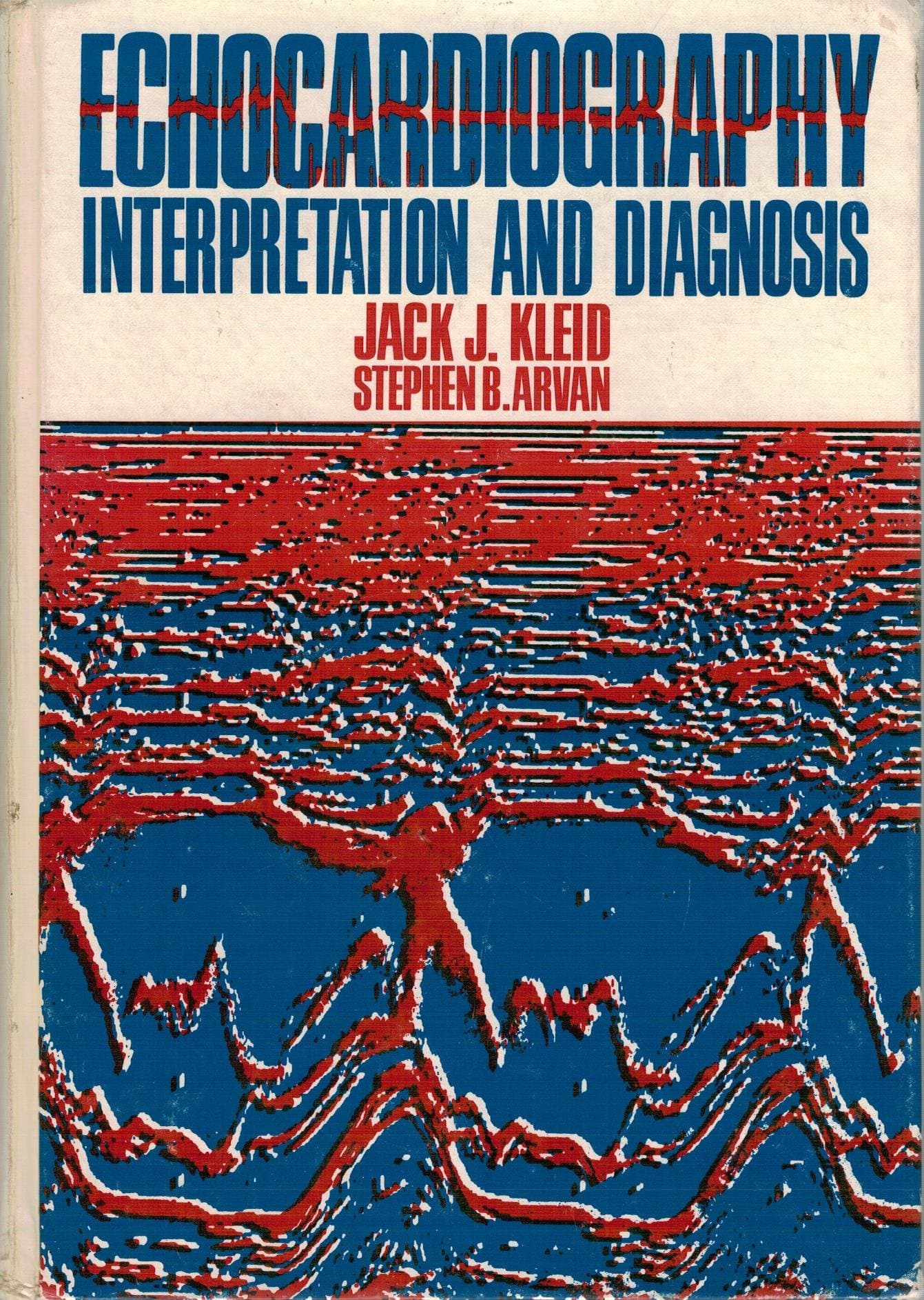 Echocardiography: Interpretation & Diagnosis Kleid, Jack and Arvan, Stephen B. by null
