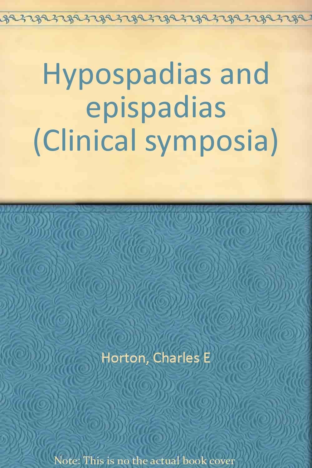 Hypospadias and epispadias (Clinical symposia) Horton, Charles E by null
